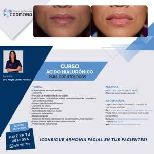 Curso Ácido Hialurónico Octubre 2021