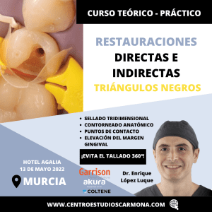 Restauraciones directas e indirectas