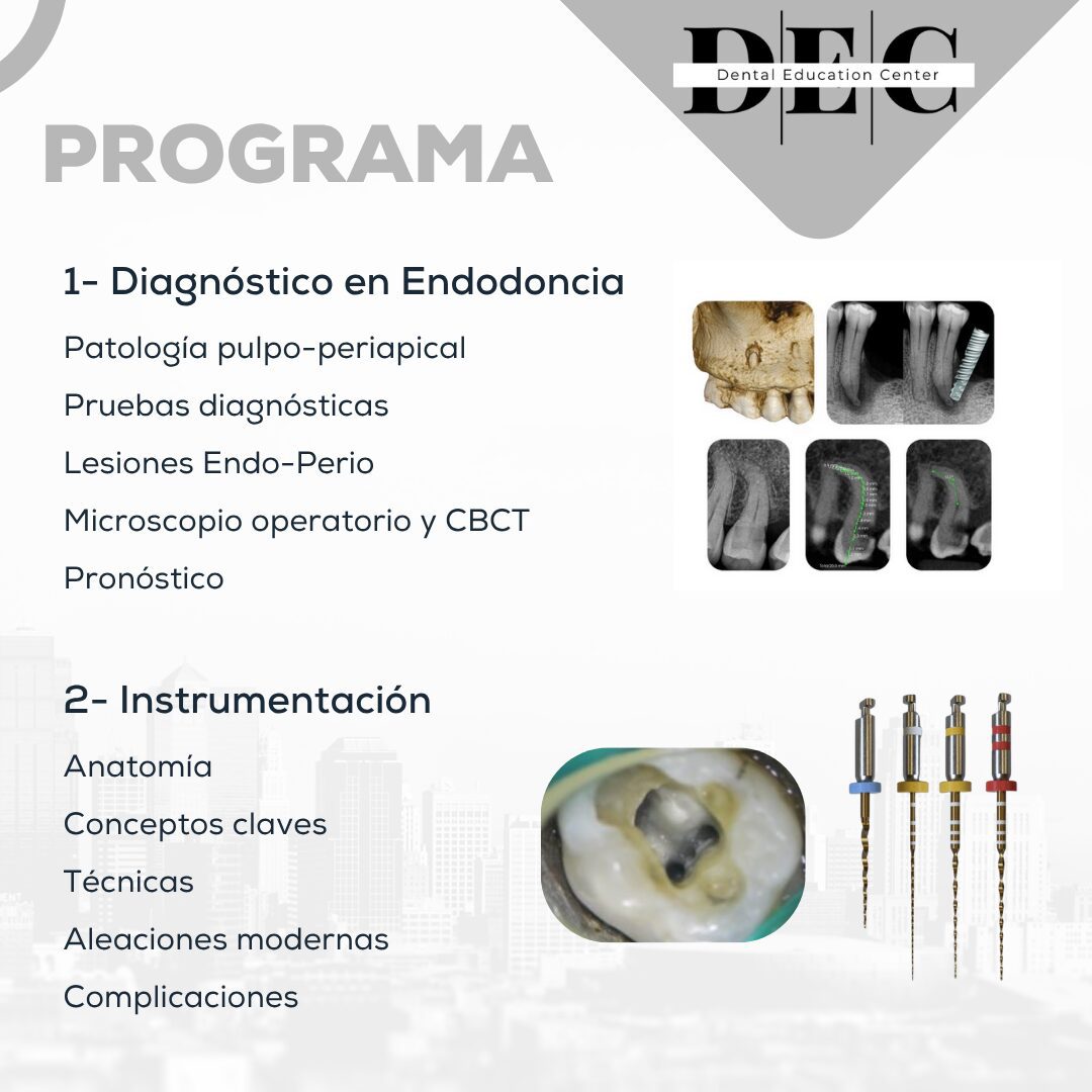 Curso Actualización en Endodoncia Clínica en Murcia - 6 de febrero 2026 - Imagen 5